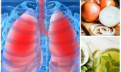 Thực phẩm mát gan bổ phổi, chống lại sự phát triển ung thư, chớ dại mà bỏ qua