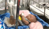 Cha ruột đánh con trai 4 tháng tuổi gãy chân, xuất huyết não chỉ vì bé khóc không chịu nín