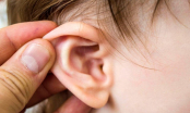 Bệnh viêm tai giữa ở trẻ có dấu hiệu gì, nghiêm trọng thế nào và cách phòng tránh ra sao?