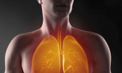8 cách lọc sạch phổi ngay tại nhà trong mùa dịch Covid-19