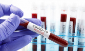 Chuyên gia Trung Quốc: Người nhóm máu A dễ nhiễm Covid-19