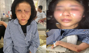 Chân dung cô gái trẻ xinh đẹp bị tra tấn, đánh đập dã man suốt 2 tiếng