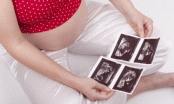 6 sự thật bất ngờ trong thời gian mang thai, bác sĩ hiếm khi tiết lộ với mẹ bầu