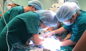 Phẫu thuật cho hai bé song sinh dính liền nhau: Tỷ lệ cứu sống hai bé là 74%