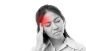 Cách giảm đau nửa đầu không cần dùng thuốc, dù bạn là ai cũng nên biết