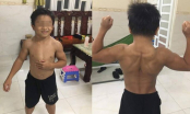 Cậu bé 10 tuổi cơ bắp cuồn cuộn dù không hề tập luyện do mắc hội chứng hiếm gặp