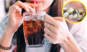 Cô gái 25 tuổi bị sâu 10 chiếc răng vì thói quen uống nước tai hại, nhiều người cũng mắc phải lỗi tương tự