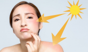 4 lỗi sai trầm trọng khi chăm sóc da mùa đông khiến làn da khô nứt nẻ