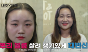 Stylist xứ Hàn bày cách chữa cháy cho mái tóc mỏng dính, từng sợi thưa thớt