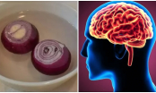 5 triệu chứng chứng tỏ bạn đang bị thiếu máu não: Bs khuyên ăn nhiều 3 loại rau giúp lưu thông máu