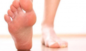 Bàn chân là bộ não thứ 2 của con người: Nếu xuất hiện 4 triệu chứng cảnh báo gan bị tổn thương