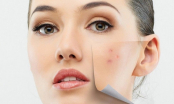 Làn da có thể bị phá hủy và tổn thương vì loạt thói quen thường thấy sau