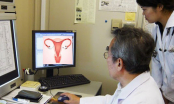 7 việc độc hại phụ nữ 'vô tư' làm trong ngày đèn đỏ gây viêm nhiễm phụ khoa, tử cung sinh bệnh