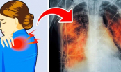 Tự kiểm tra sức khỏe của phổi thông qua 6 dấu hiệu: Xuất hiện 1 điểm cũng đáng lo ngại, cần điều trị gấp