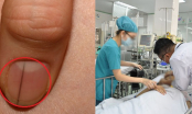5 dấu hiệu bất thường ở ngón tay cảnh báo bệnh nguy hiểm, hãy đến gặp bác sĩ ngay
