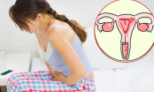 4 dấu hiệu cảnh báo tử cung của bạn không khỏe, nên đi kiểm tra sớm