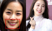 Sao Hàn lên đời nhan sắc nhờ chỉnh răng, đến Kim Tae Hee cũng không ngoại lệ