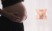Bệnh tuyến giáp khiến phụ nữ khó thụ thai: Rất tiếc, nhiều người lại nhầm tưởng rối loạn đèn đỏ thông thường