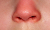 Mũi là 'đèn tín hiệu' của phổi: 3 dấu hiệu bất thường ở mũi chứng tỏ phổi đang ủ bệnh