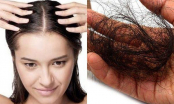 Rụng tóc nhiều đến mấy cứ thử 7 mẹo dân gian: Tóc giảm rụng nhanh chóng, mọc chắc khỏe trở lại