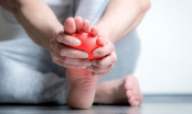 6 kiểu đau chân cảnh báo bệnh: Tưởng đau nhức thông thường nhưng có thể là suy tim, suy thận