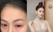 Hoa hậu Phương Khánh gặp vấn đề nghiêm trọng ở mắt, phải huỷ bỏ mọi lịch trình
