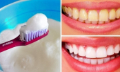 8 cách làm trắng răng bị ố vàng tại nhà: An toàn, hiệu quả