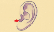 Cổ nhân nói tài vận đến từ đôi tai: 3 kiểu tai giàu có vinh hoa, càng lớn tuổi càng may mắn