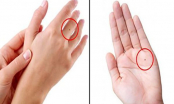 4 nốt ruồi ở lòng bàn tay tượng trưng cho Tài - Lộc - Phát - Thọ chỉ 1/4 cũng sung túc viên mãn