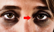 Các cụ dạy cấm sai: Người hai mắt trũng sâu thâm đen, xám xịt chớ lại gần, vì sao vậy?