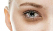 6 loại thực phẩm giúp chị em cải thiện quầng thâm mắt ngay từ bên trong