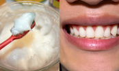 Dùng thứ này để đánh răng: Cao răng bong sạch, hôi miệng kinh niên cũng đỡ hẳn