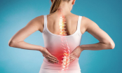 Vị trí đau lưng nói lên tình trạng sức khỏe của bạn