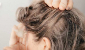 3 công thức tẩy da chết cho da đầu hiệu quả, được xem là “chìa khóa” giúp tóc chắc khỏe