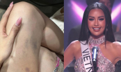 Ngọc Châu gây xót xa với đôi chân bầm dập, đôi mắt đỏ hoe khi trượt top 16 tại Miss Universe 2022