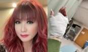 Vợ cũ Bằng Kiều bị tai nạn đổ máu đầu năm mới, một mình lái xe vào viện