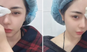 Bạn gái Huỳnh Anh công khai diện mạo mới sau khi thẩm mỹ