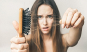 7 chiêu đơn giản giúp giải quyết tình trạng tóc khô xơ gãy rụng trong thời gian ngắn