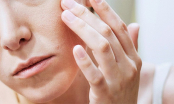 4 loại mặt nạ cải thiện tình trạng da bị khô sần, thô ráp