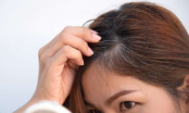 Mẹo ngăn ngừa tóc bạc sớm giúp chị em tự tin hơn với ngoại hình tươi trẻ