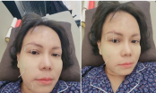 Việt Hương tiết lộ tình trạng sức khỏe hiện tại sau sự cố bị méo một bên mặt