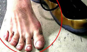 Các cụ nói: 'Ngón chân thứ hai dài hơn ngón cái, lớn lên không hiếu thuận', có đúng không?