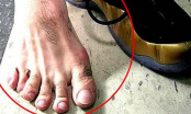 Người xưa nói: 'Ngón chân thứ hai dài hơn ngón cái, lớn lên không hiếu thuận', có đúng không?