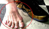 Các cụ nói: Ngón chân thứ hai dài hơn ngón cái, lớn lên không hiếu thuận, có thật sự đúng?