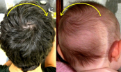 Xoáy tóc trên đầu có thể tiết lộ vận mệnh tương lai, đếm xem con bạn bao nhiêu xoáy?