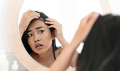 5 cách trị rụng tóc, hói đầu giúp mái tóc bồng bềnh như suối mây