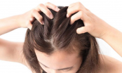 Bật mí một số cách tẩy tế bào da đầu để tóc chắc khỏe, bóng mượt