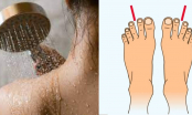 Bác sĩ da liễu tiết lộ 3 vị trí bẩn nhất trên cơ thể nhưng nhiều người thường bỏ qua khi tắm