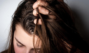 6 cách cấp cứu mái tóc bết dầu khiến nàng mất tự tin