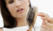 Mẹo chăm sóc tóc thời điểm giao mùa, giúp giảm gãy rụng và phục hồi tóc khô xơ